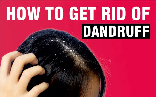 How to Get Rid of Dandruff From Hair?