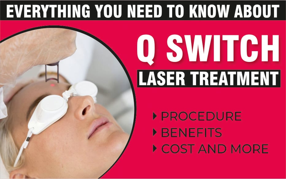 Q Switch Laser Treatment